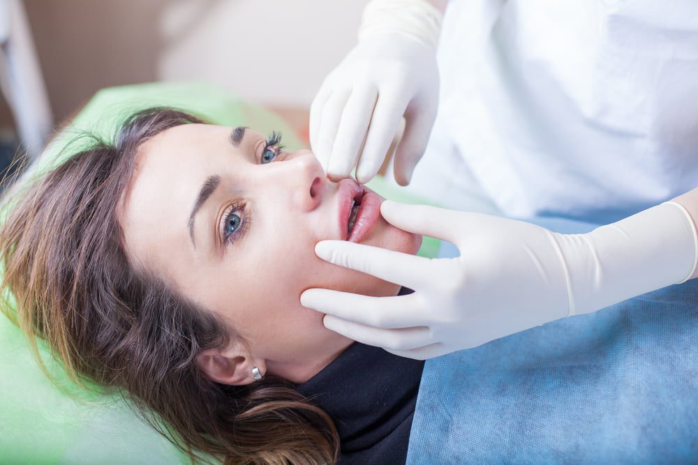 How to Prevent Lip Filler Migration : 7 Effective Ways