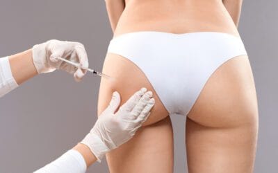 O que é Sculptra Butt Lift: Prós e Contras