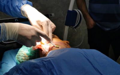 What is Facetite Procedure: Benefits, Complications, Recovery and Cost