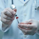 Penganalisis Hitung Darah Lengkap (CBC)