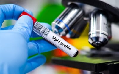 Analisador de teste de lipídios